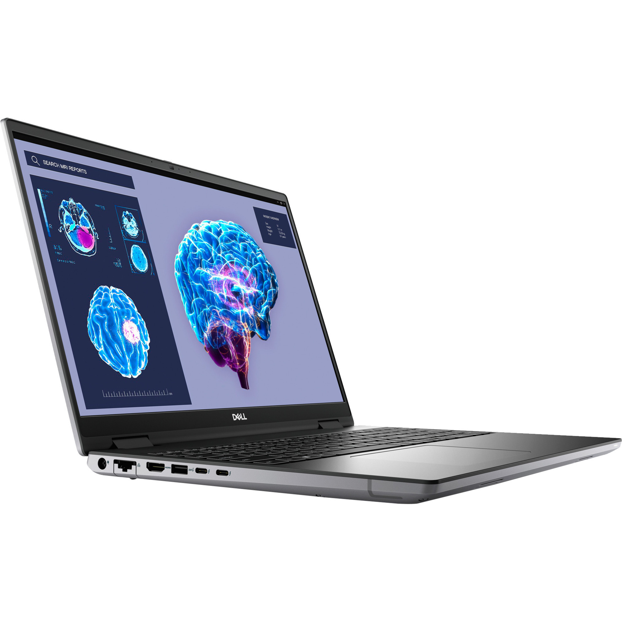 Precision 7680-MVHK0, Notebook
